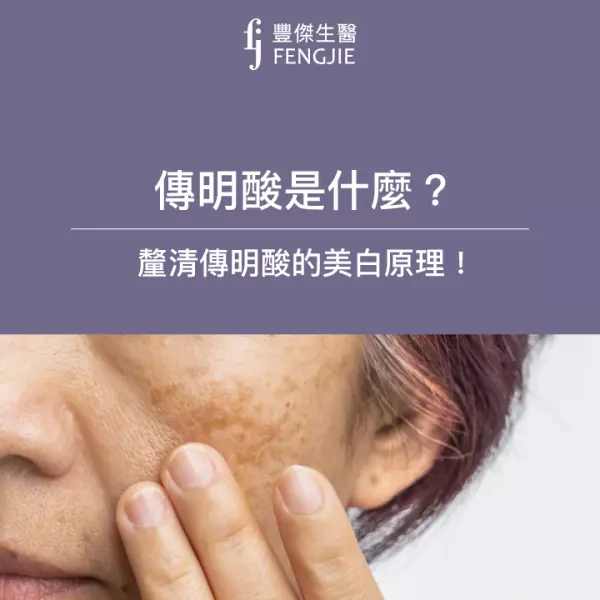 傳明酸是什麼?釐清傳明酸的美白原理!