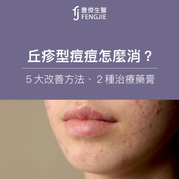 丘疹型痘痘怎麼消?專家揭改善5大方法!這2種藥膏可治療