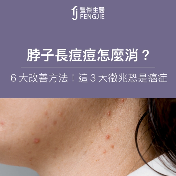 脖子長痘痘怎麼消?專家:6大改善方法!這3大徵兆恐是癌症