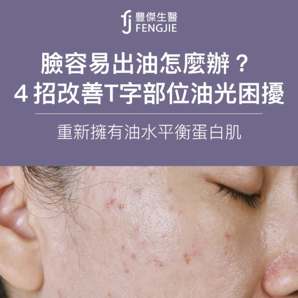 臉容易出油怎麼辦?專家:4招改善T字部位油光困擾