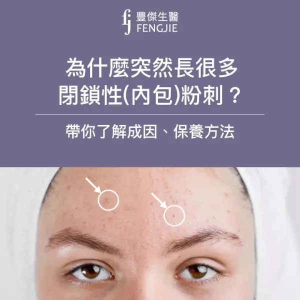 為什麼突然長很多閉鎖性(內包)粉刺?帶你了解成因、保養方法
