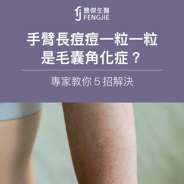 手臂長痘痘一粒一粒是「毛囊角化症」?專家教你5招解決