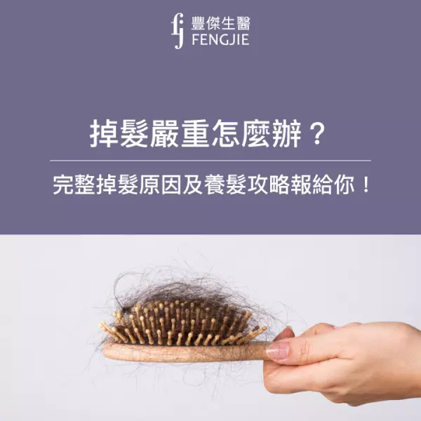 掉髮嚴重怎麼辦?3招檢測掉髮程度,完整掉髮原因及養髮攻略報給你!