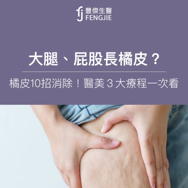 大腿、屁股長橘皮?專家:橘皮10招消除!醫美3大療程一次看