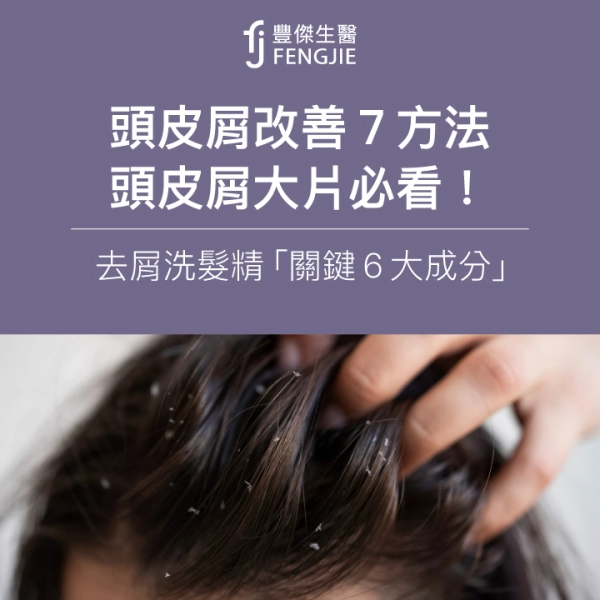 頭皮屑改善7方法:頭皮屑大片必看!去屑洗髮精「關鍵6大成分」