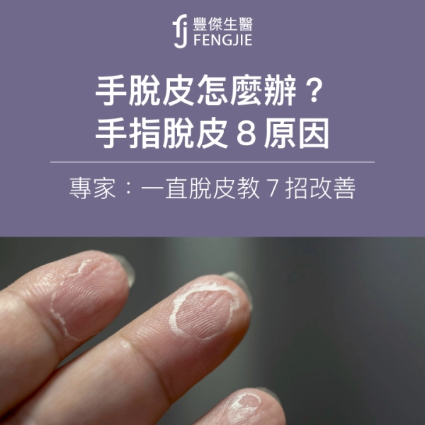手脫皮怎麼辦?手指脫皮8原因,專家:一直脫皮教7招改善