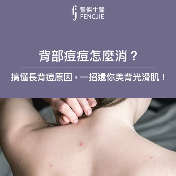 背部痘痘怎麼消?先搞懂長背痘原因,一招還你美背光滑肌!