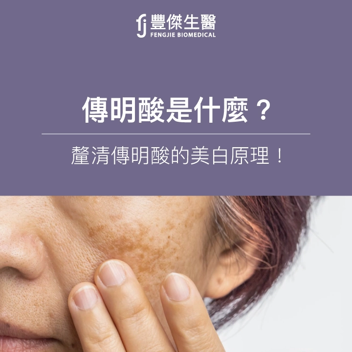 傳明酸是什麼？釐清傳明酸的美白原理！