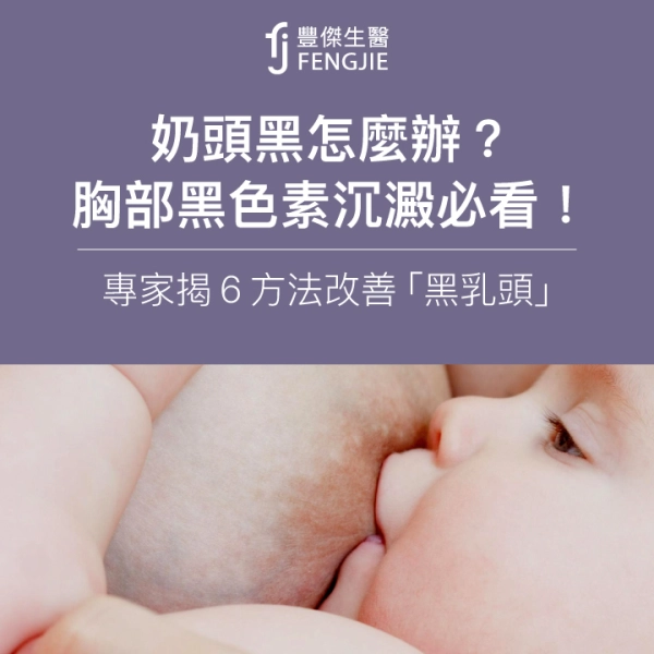 奶頭黑怎麼辦?胸部黑色素沉澱必看!專家揭6方法改善「黑乳頭」