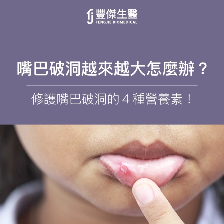 嘴巴破洞越來越大？舌頭破洞白色？營養師：快吃4大營養素！