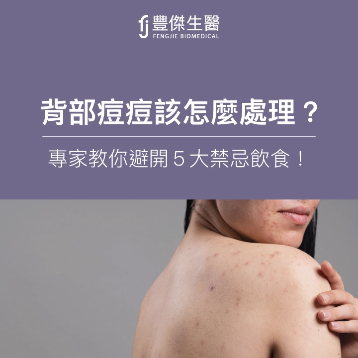 背長痘痘怎麼辦？專家告訴你「痘痘飲食」該怎麼吃