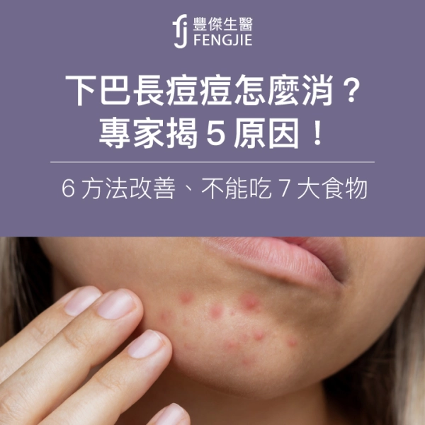 下巴長痘痘怎麼消?專家揭5原因!6方法改善、不能吃7大食物