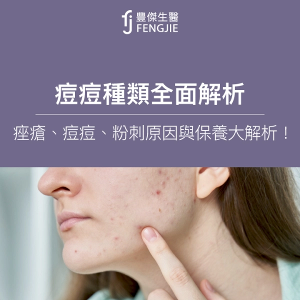痘痘種類全面攻略:痤瘡、痘痘、粉刺原因與保養大解析!