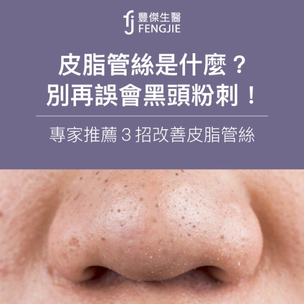 皮脂管絲是什麼?別再誤會黑頭粉刺!專家推薦3招改善皮脂管絲