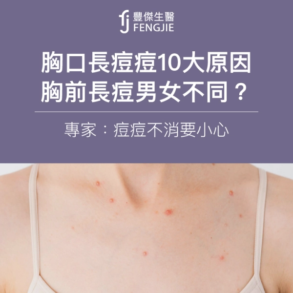 胸口長痘痘10大原因,胸前長痘男女不同?專家:痘痘不消要小心