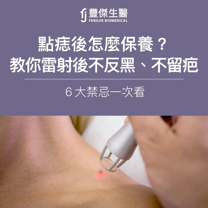 點痣後怎麼保養?專家教你雷射後不反黑、不留疤,6大禁忌一次看