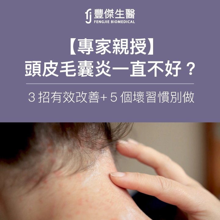 【專家親授】頭皮毛囊炎好不了?專家揭「你常做的5個壞習慣」必改!