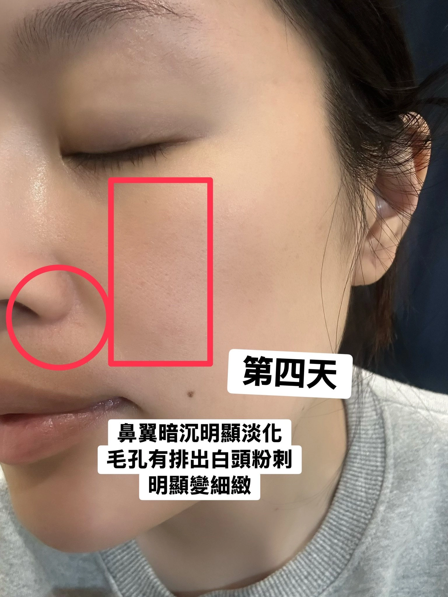 豐傑生醫的【富勒烯肌因逆齡霜】