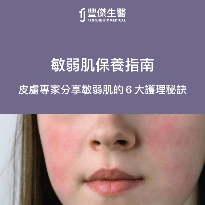 敏弱肌保養指南：皮膚專家分享敏弱肌的6大護理秘訣
