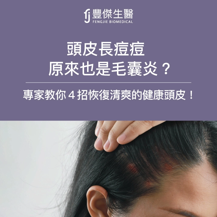 頭皮長痘痘原來也是毛囊炎？專家教你4招恢復清爽的健康頭皮！