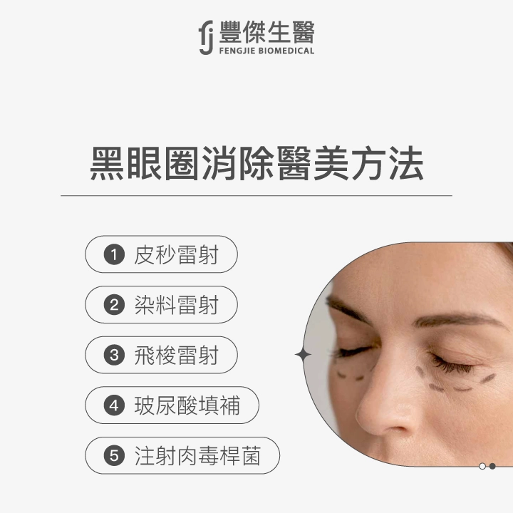 黑眼圈消除醫美方法:皮秒雷射、染料雷射、飛梭雷射、玻尿酸填補、注射肉毒桿菌