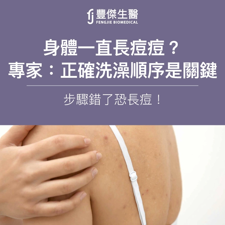 身體一直長痘痘?專家:正確洗澡順序是關鍵,步驟錯了恐長痘!