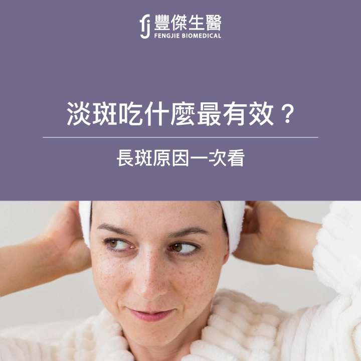 淡斑吃什麼最有效?長斑原因一次看,專家公布「外用內調」的搭配關鍵