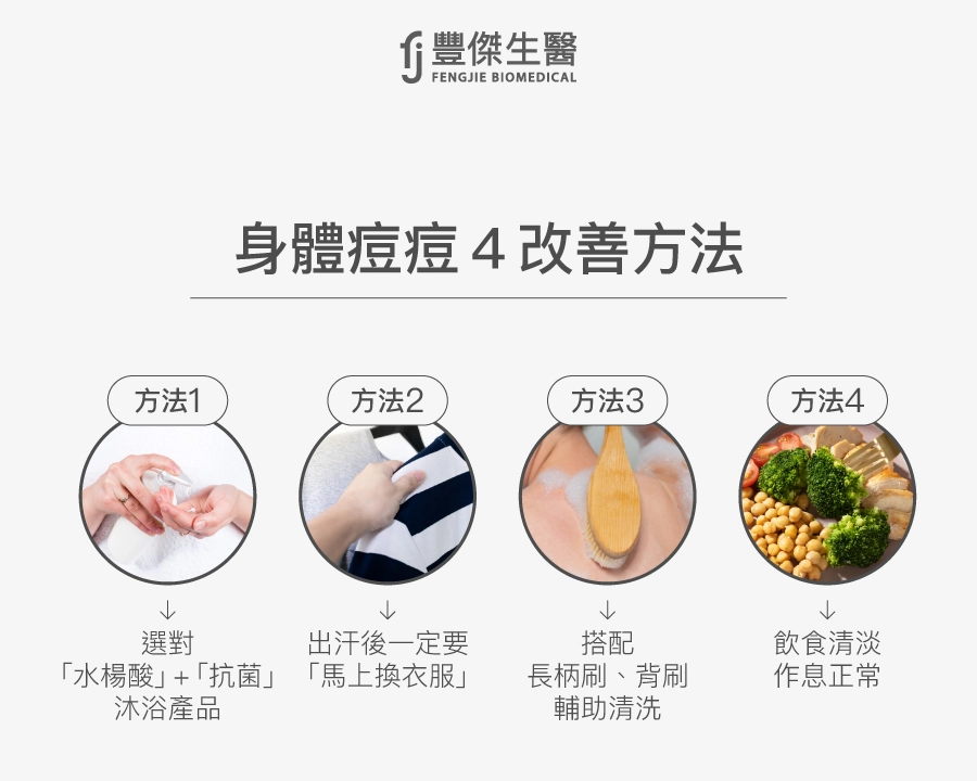 身體痘痘4改善方法:選對水楊酸抗菌沐浴品、出汗後馬上換衣服、搭配長柄背刷清洗、飲食清淡作息正常