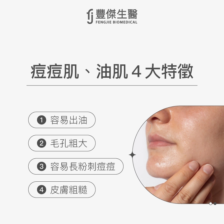 痘痘肌與油性肌膚4大特徵:出油旺盛、毛孔粗大、容易長痘、皮膚粗糙