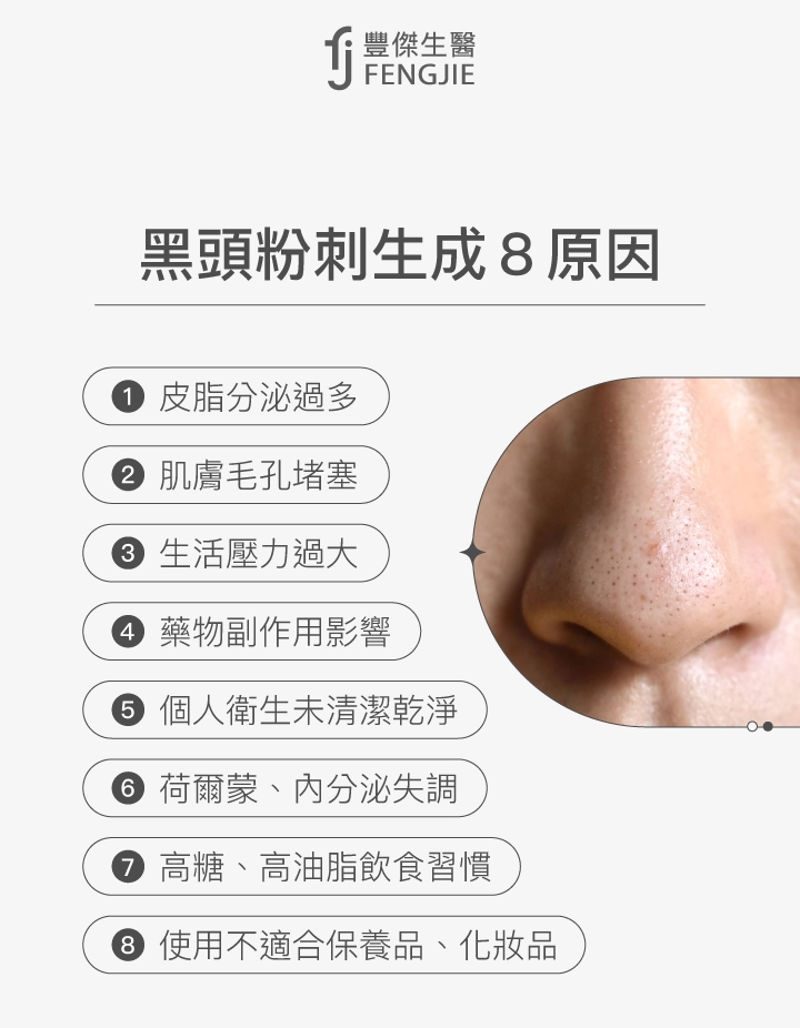 黑頭粉刺生成8原因:皮脂分泌過多、肌膚毛孔堵塞、生活壓力過大、藥物副作用影響、個人衛生未清潔乾淨、荷爾蒙與內分泌失調、高糖高油脂飲食習慣、使用不適合保養品與化妝品。
