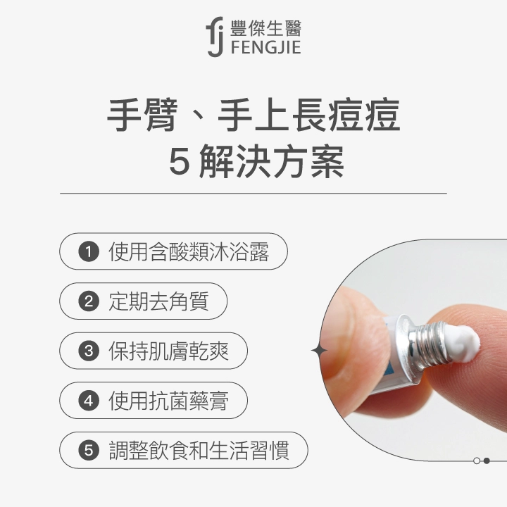 手臂、手上長痘痘5解決方案：使用含酸類沐浴露、定期去角質、保持肌膚乾爽、使用抗菌藥膏、調整飲食和生活習慣