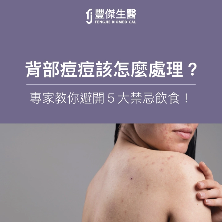 背部長痘痘怎麼辦？專家教你6招「預防背部痘痘」+ 5大禁忌飲食！