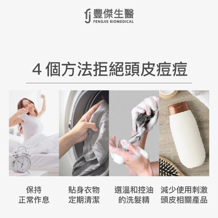 4個方法拒絕頭皮痘痘
