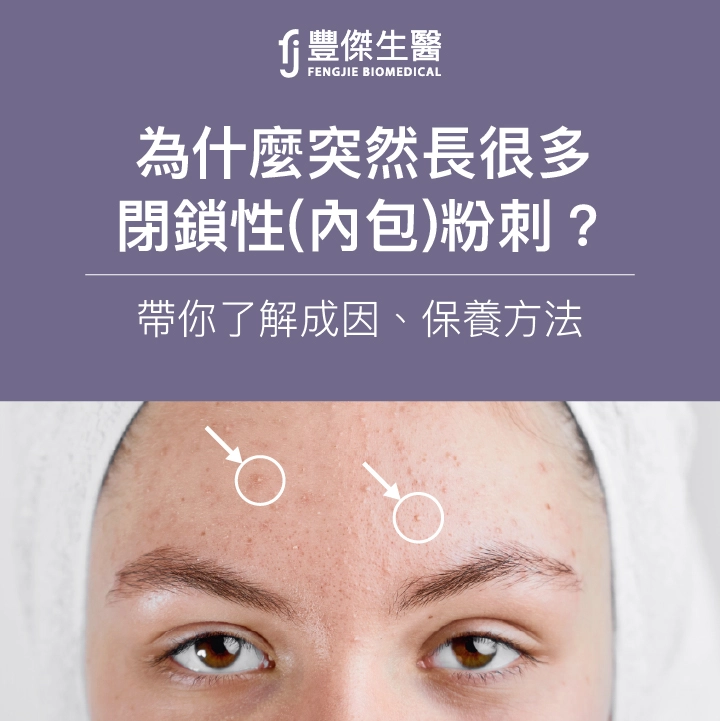 為什麼突然長很多閉鎖性（內包）粉刺？帶你了解成因、保養方法