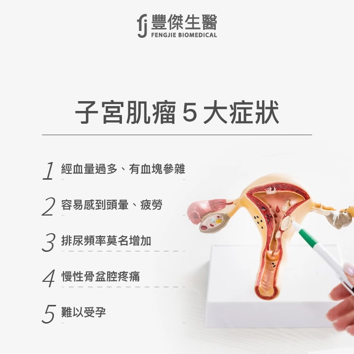 子宮肌瘤5大症狀:經血量過多、有血塊參雜、容易感到頭暈、疲勞、排尿頻率莫名增加、慢性骨盆腔疼痛、難以受孕