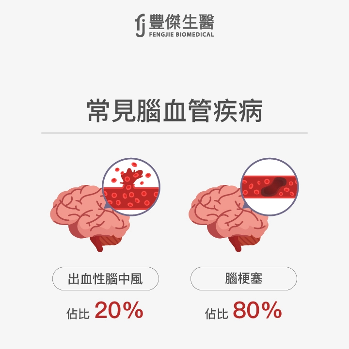 出血性中風、腦梗塞是常見的腦血管疾病