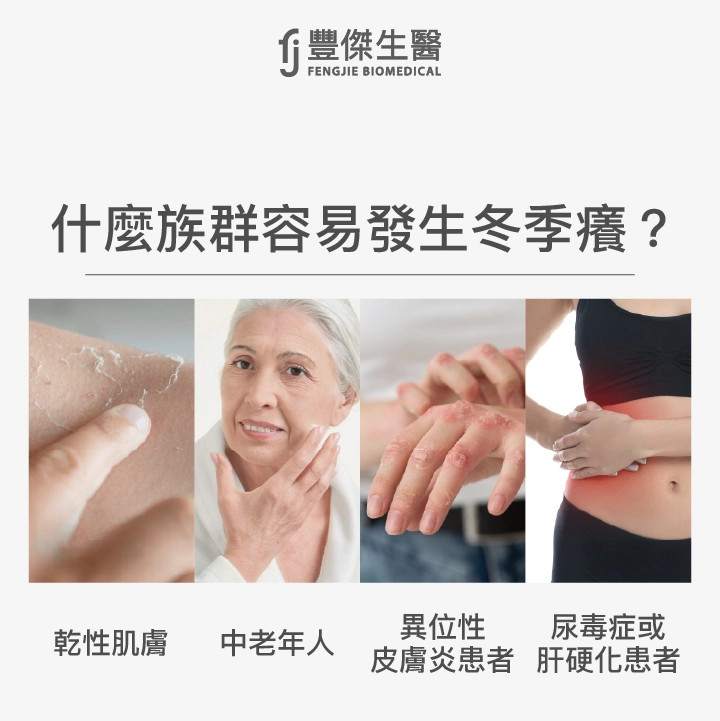 什麼族群容易發生冬季癢