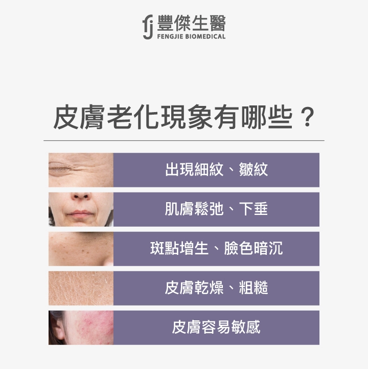 皮膚老化現象有哪些?