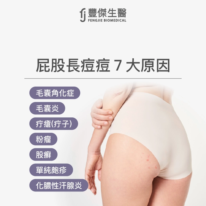 屁股長痘痘7大原因：毛囊角化症、毛囊炎、疔瘡（疔子）、粉瘤、股癬、單純皰疹、化膿性汗腺炎