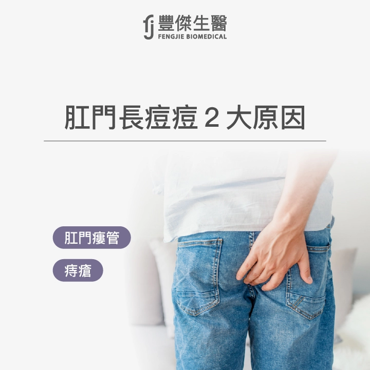 肛門長痘痘2大原因：肛門瘻管、痔瘡