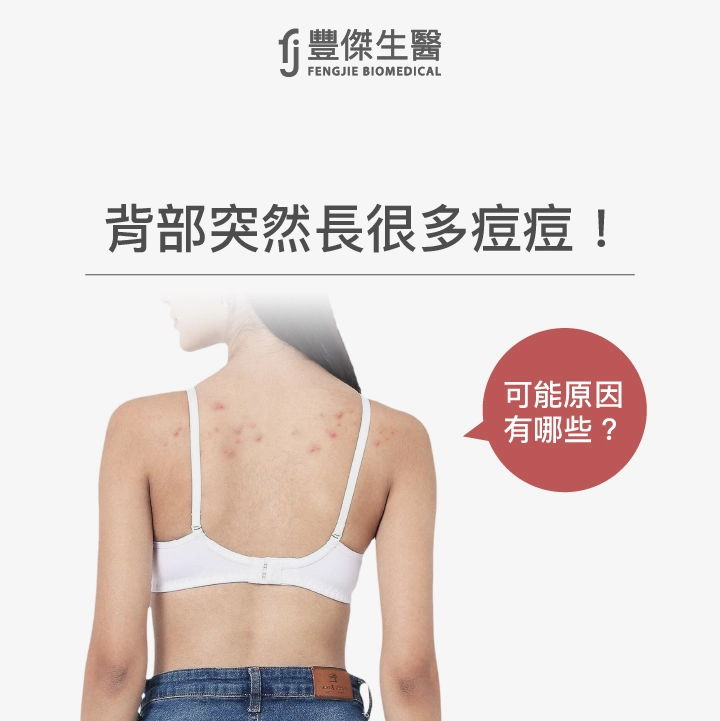 為什麼背後突然長痘痘