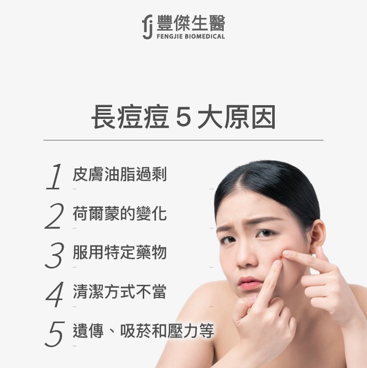 長痘痘5大原因：皮膚油脂過剩、荷爾蒙的變化、服用特定藥物、清潔方式不當、遺傳、吸菸和壓力等