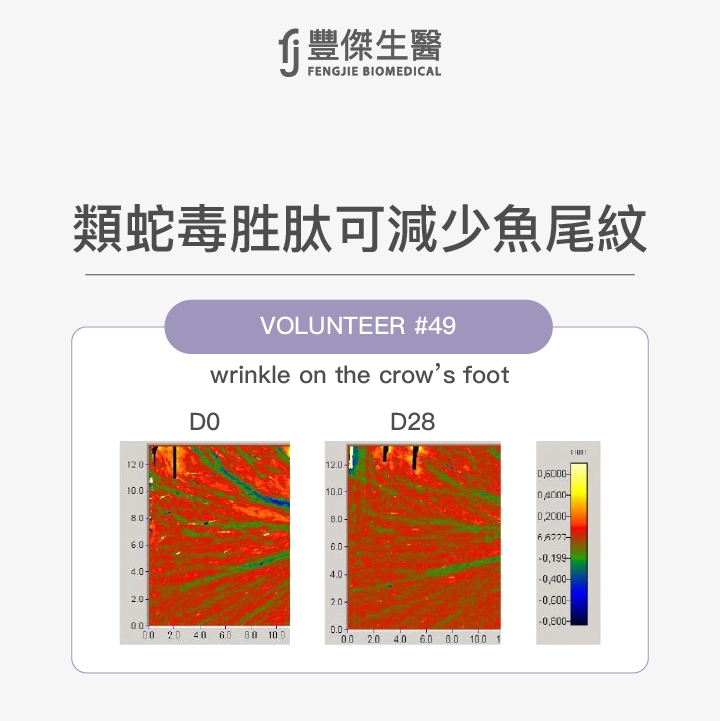 類蛇毒胜肽可減少魚尾紋