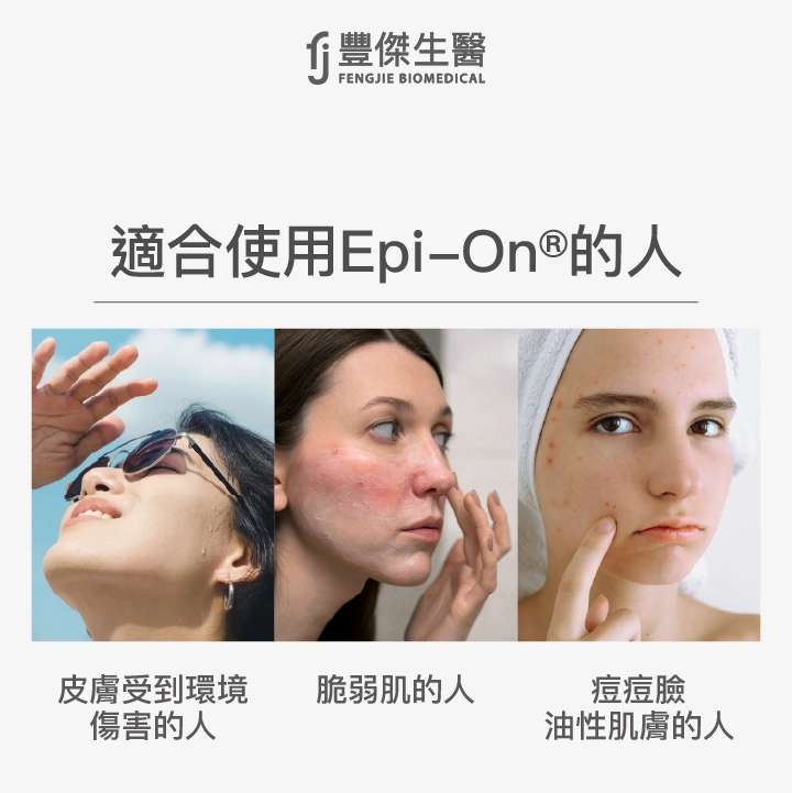 適合使用Epi-On®的人：皮膚受到環境傷害的人、修修臉的人、痘痘臉、油性肌膚的人