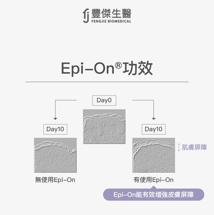 Epi-On®能有效增強皮膚屏障