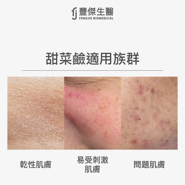 甜菜鹼保養品適合族群包括乾性肌膚、易受刺激肌膚及問題肌膚的人