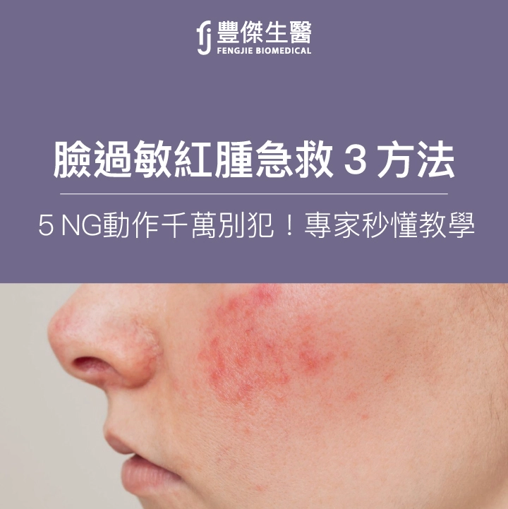臉過敏紅腫急救3方法，5大NG動作千萬別犯！專家秒懂教學