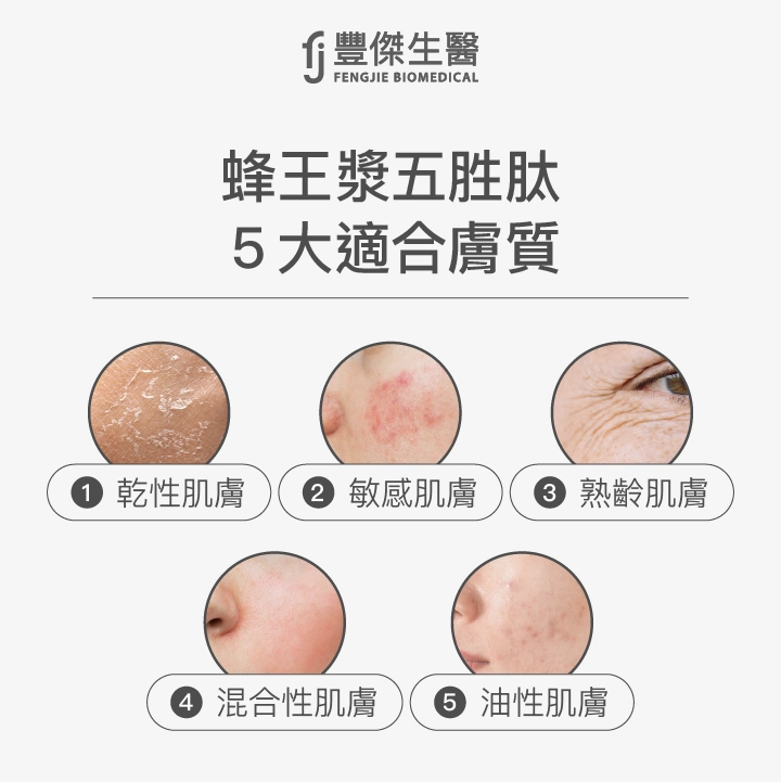 蜂王漿五胜肽5大適合膚質：乾性肌膚、敏感肌膚、熟齡肌膚、混合性肌膚、油性肌膚