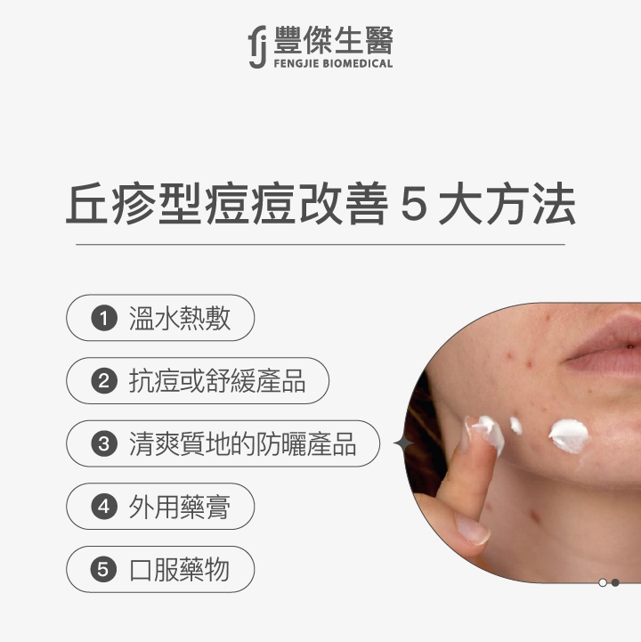 丘疹型痘痘改善5大方法：溫水熱敷、抗痘或舒緩產品、清爽質地的防曬產品、外用藥膏、口服藥物
