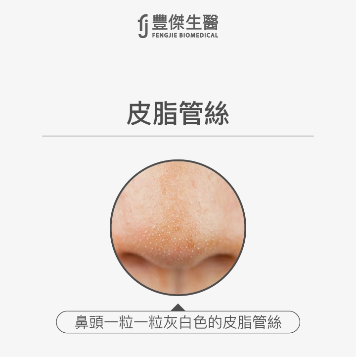 皮脂管絲構造